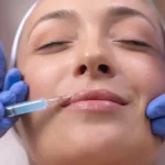 How Plastic Surgery Can Help