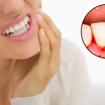 Role of Gum Health