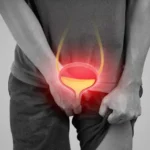 What Is Acute Bladder Retention and Why Is It a Medical Emergency